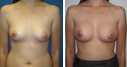 Before & After Photos